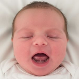 舌系带手术后：陪宝宝重新学会亲喂